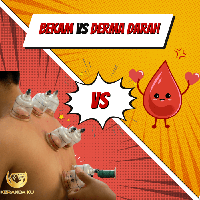 Pusat Bekam Sunnah (@pusatbekam_com) | Twitter