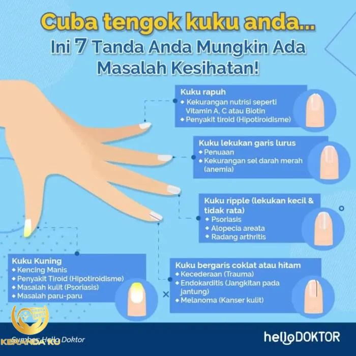 Sunnah potong kuku