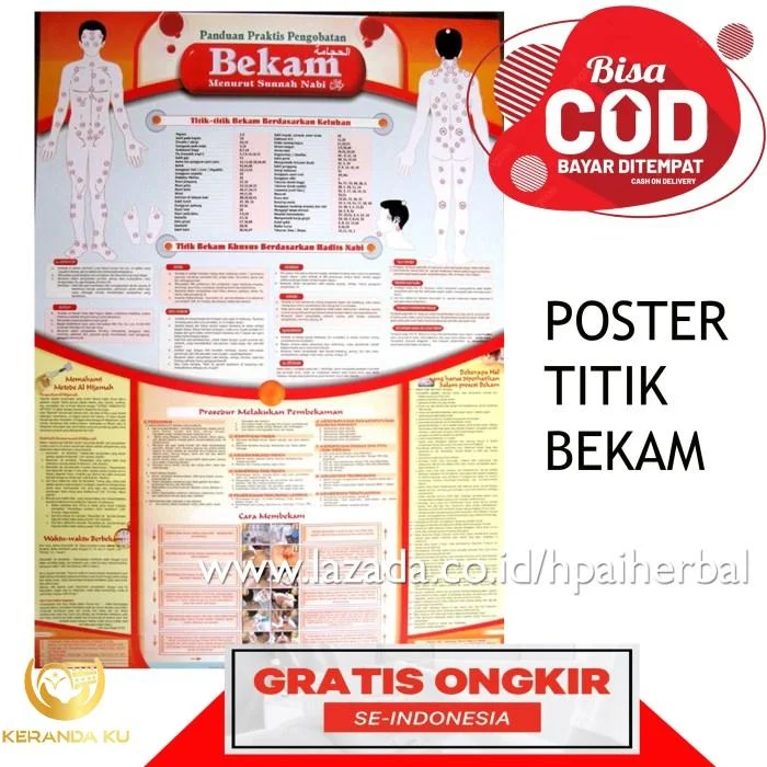 Titik bekam sunnah